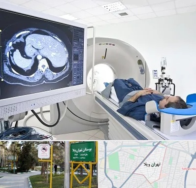 مرکز تصویر برداری پزشکی در تهران ویلا