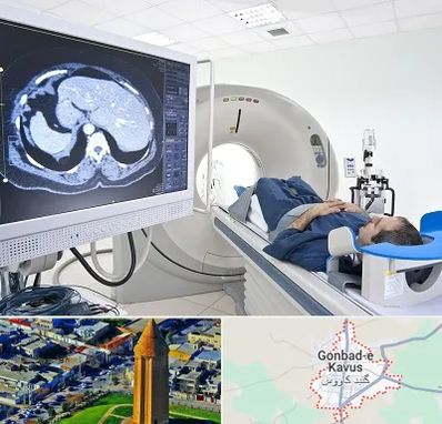 مرکز تصویر برداری پزشکی در گنبد کاووس
