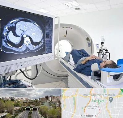 مرکز تصویر برداری پزشکی در یوسف آباد 