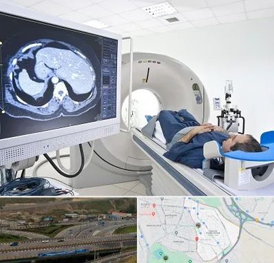 مرکز تصویر برداری پزشکی در یاغچیان تبریز