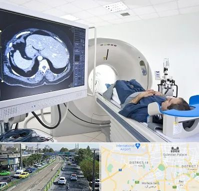 مرکز تصویر برداری پزشکی در جنوب تهران 