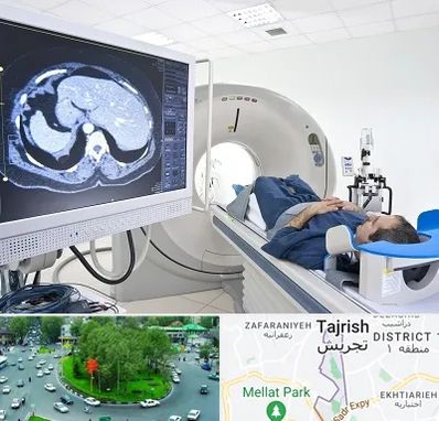 مرکز تصویر برداری پزشکی در تجریش 