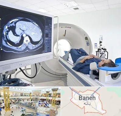 مرکز تصویر برداری پزشکی در بانه