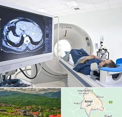 مرکز تصویر برداری پزشکی در آمل