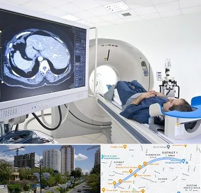 مرکز تصویر برداری پزشکی در اندرزگو