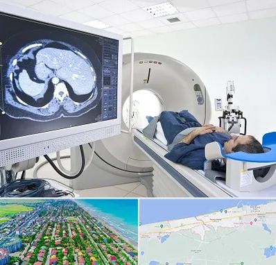 مرکز تصویر برداری پزشکی در فریدونکنار