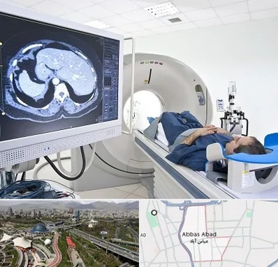 مرکز تصویر برداری پزشکی در عباس آباد تهران