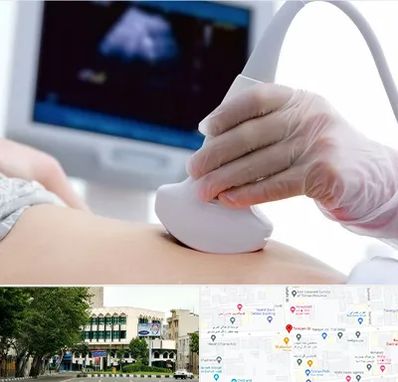 سونوگرافی در طالقانی