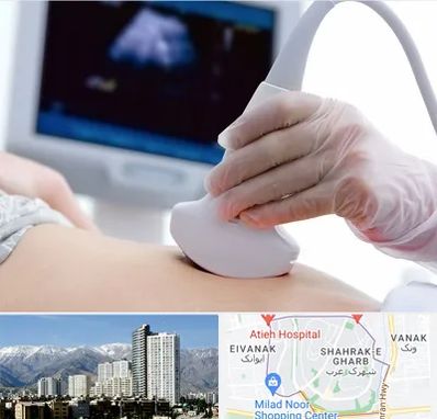 سونوگرافی در شهرک غرب