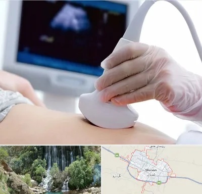 سونوگرافی در شیروان