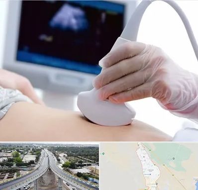 سونوگرافی در اندیمشک
