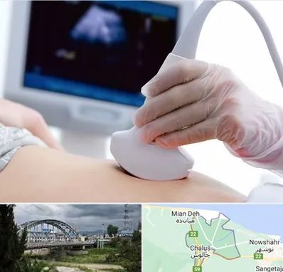 سونوگرافی در چالوس