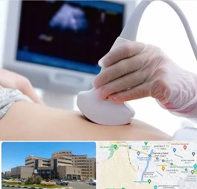 سونوگرافی در صیاد شیرازی مشهد