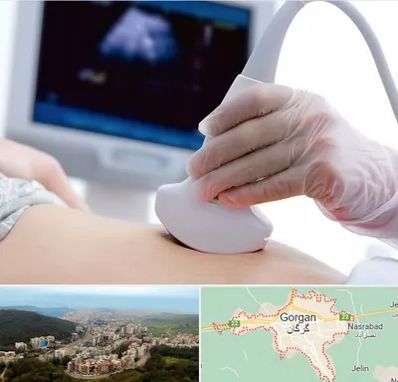 سونوگرافی در گرگان