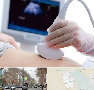 سونوگرافی در نظرآباد کرج