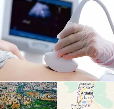 سونوگرافی در اردبیل