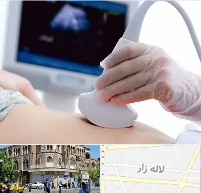 سونوگرافی در لاله زار