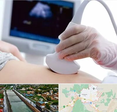 سونوگرافی در مراغه