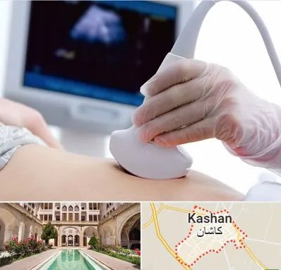 سونوگرافی در کاشان
