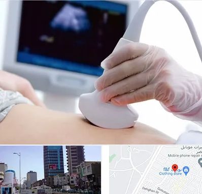 سونوگرافی در چهارراه طالقانی کرج