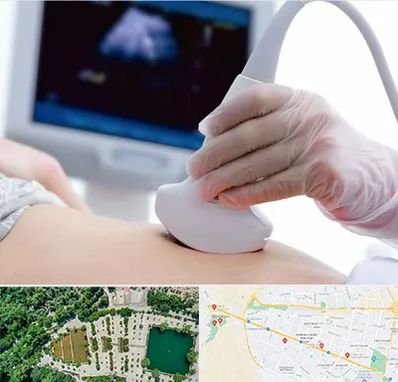 سونوگرافی در وکیل آباد مشهد