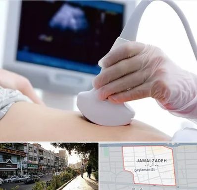 سونوگرافی در خیابان جمالزاده