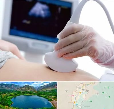 سونوگرافی در رودبار