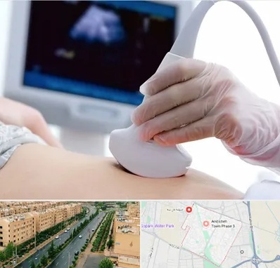سونوگرافی در فاز سه اندیشه