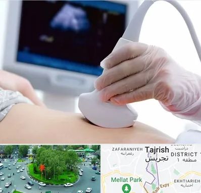 سونوگرافی در تجریش