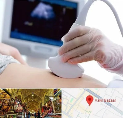 سونوگرافی در بازار وکیل شیراز