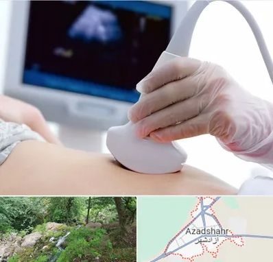 سونوگرافی در آزادشهر