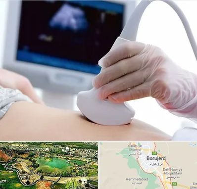 سونوگرافی در بروجرد