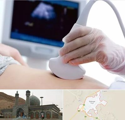 سونوگرافی در شهرضا