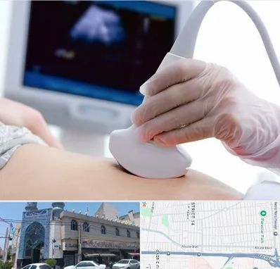 سونوگرافی در بلوار ابوذر