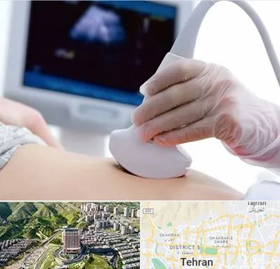 سونوگرافی در شمال تهران