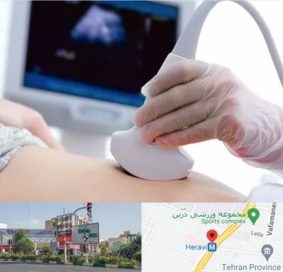 سونوگرافی در هروی