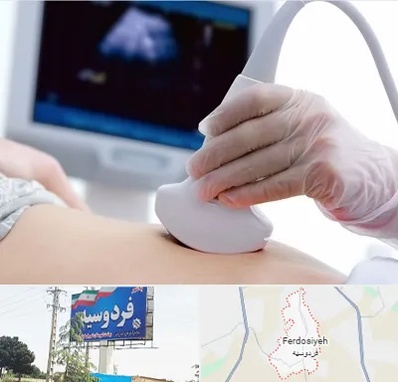سونوگرافی در فردوسیه شهریار