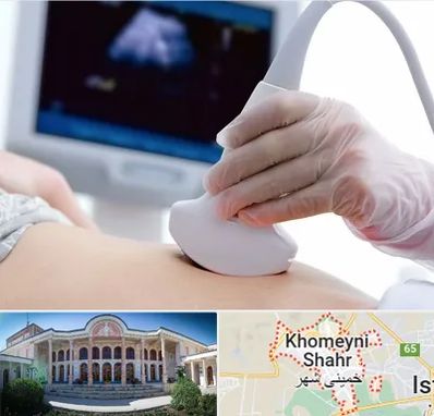 سونوگرافی در خمینی شهر