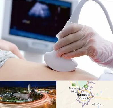 سونوگرافی در همدان