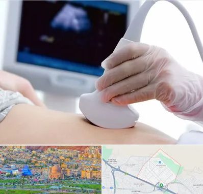 سونوگرافی در رشدیه تبریز