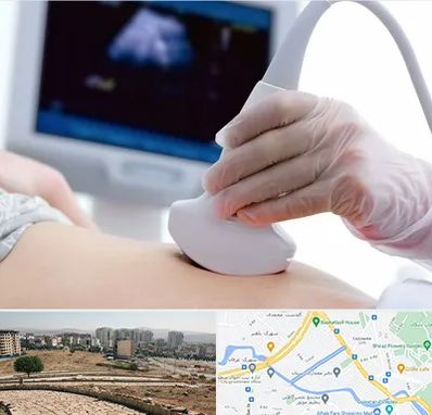 سونوگرافی در کوی وحدت شیراز