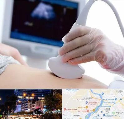 سونوگرافی در کیانپارس اهواز