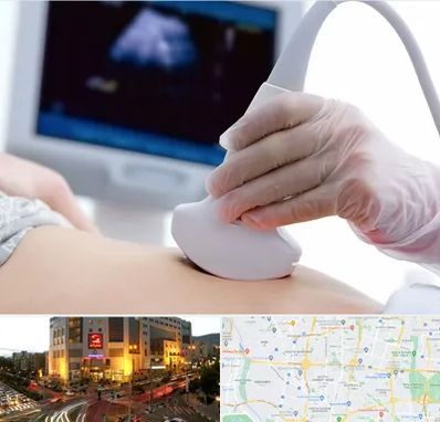 سونوگرافی در جنت آباد تهران