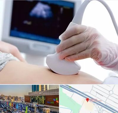 سونوگرافی در لاله پارک تبریز