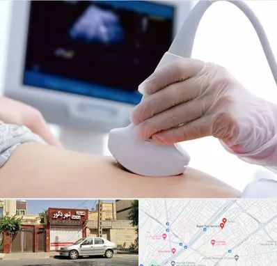سونوگرافی در باجک قم