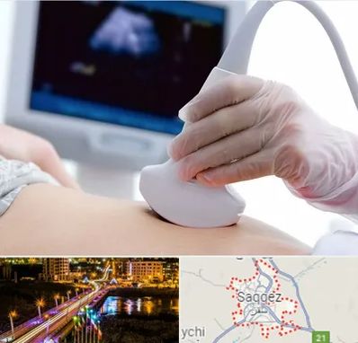 سونوگرافی در سقز