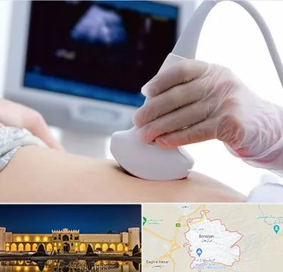 سونوگرافی در برازجان