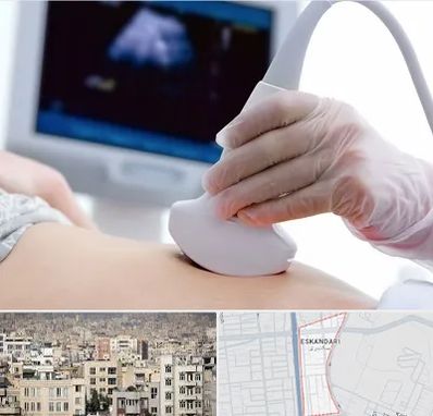 سونوگرافی در اسکندری
