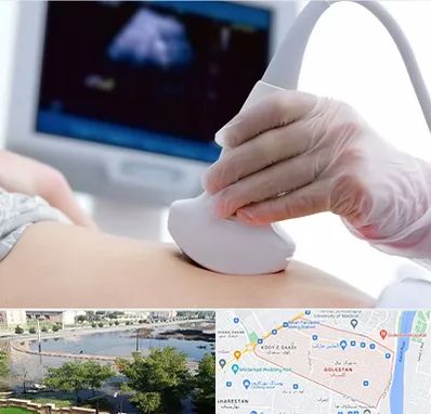 سونوگرافی در گلستان اهواز