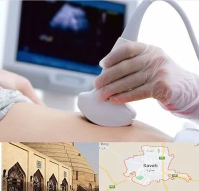 سونوگرافی در ساوه